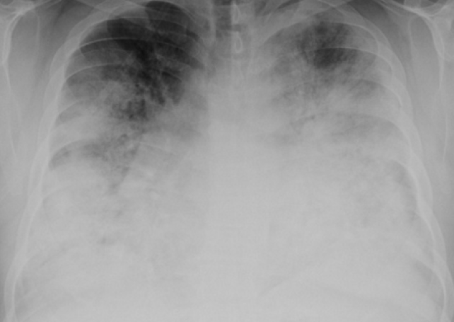 Man with Legionnaire’s disease often visited mainland