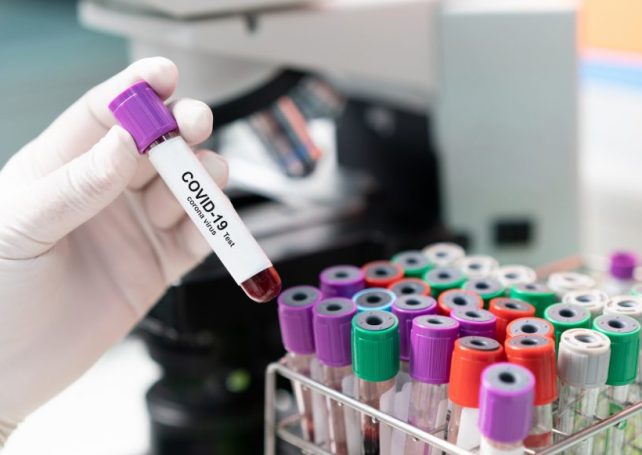 Thirty batches of pooled samples from fifth citywide NAT positive for Covid-19
