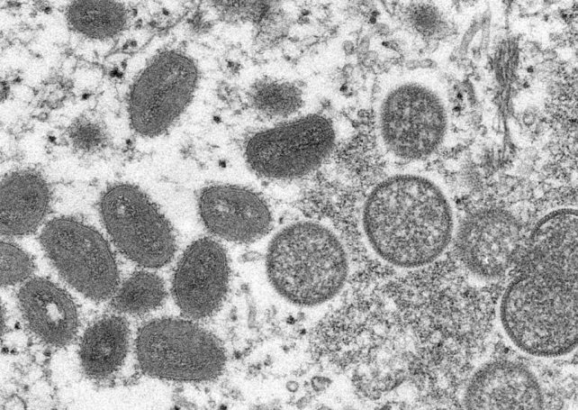 Residents warned again about virulent monkeypox disease