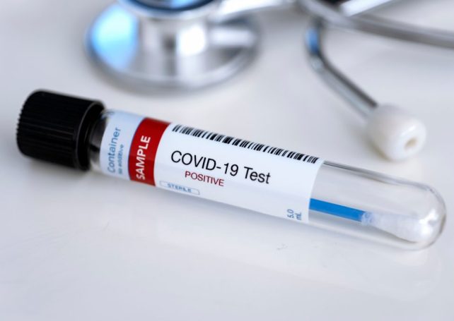 Macao recorded 402 new Covid-19 cases on Tuesday