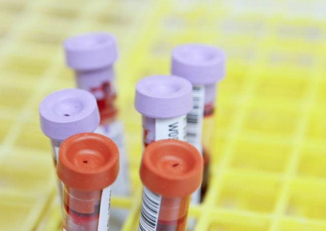 Hong Kong scientists have developed an early test for Alzheimer’s 